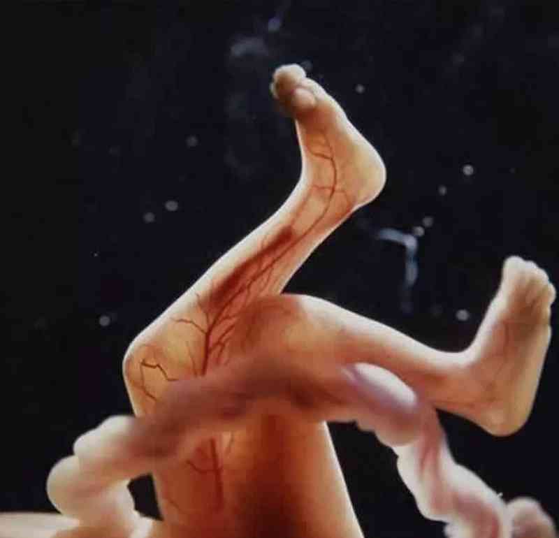 18周胎儿模型图片