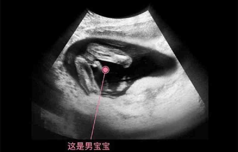 孕14周胎儿图片图片