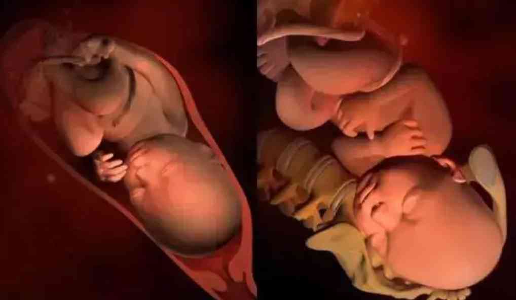 17周胎儿清晰大图图片