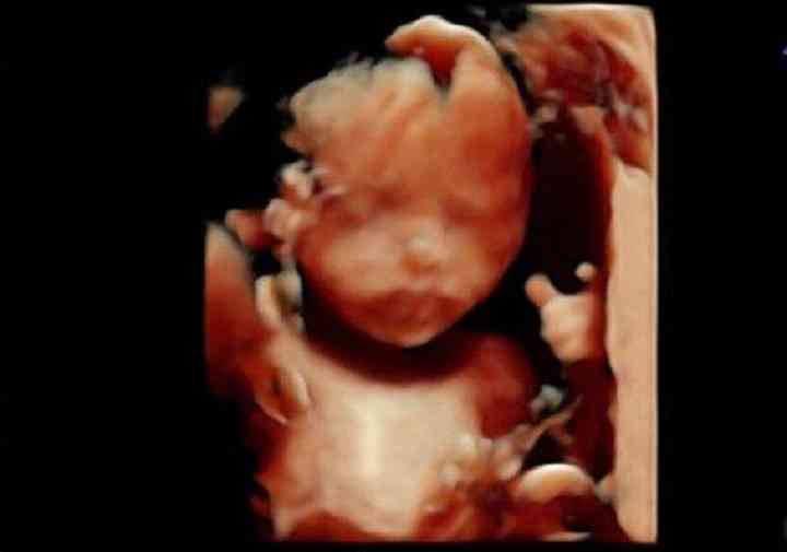 能分享几张比较清晰的十五周男女胎儿区别图吗
