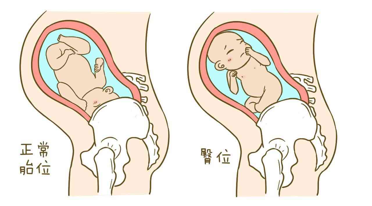 孕36周后胎儿姿势图图片