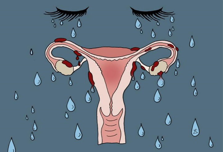 生化妊娠受精卵并不会在子宫里面着床
