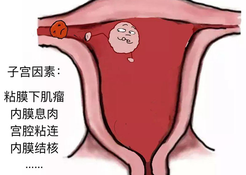 生化妊娠的常见表现