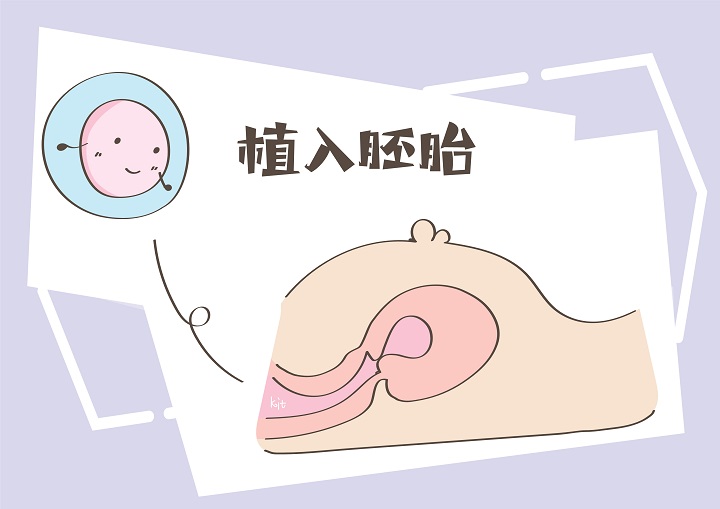 试管婴儿移植后长期卧床危害