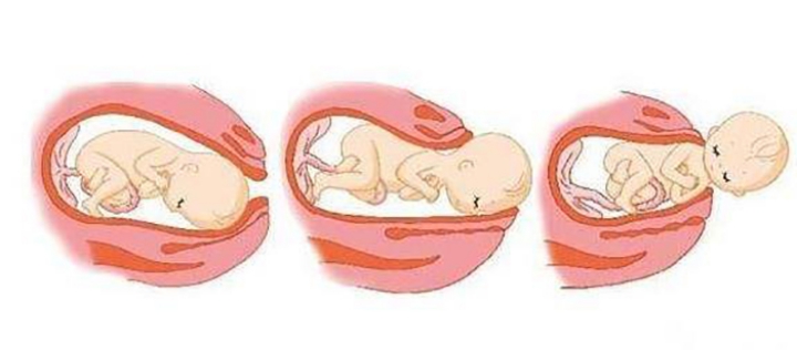 不是每一个胎儿都会在预产期出生