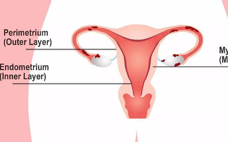 子宫内膜厚度适宜是鲜胚移植的条件
