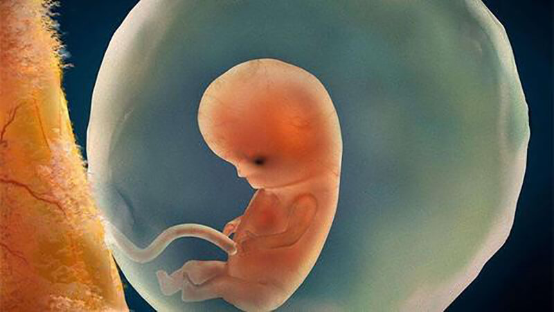 染色体异常可导致胚胎发育不良