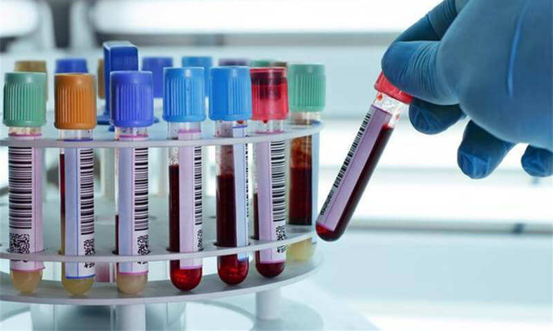 染色体检查常采用抽血的方式