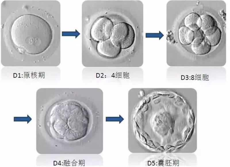 囊胚培养缺点是可导致没有胚胎可移植