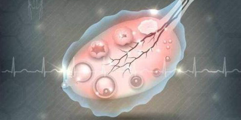 通过B超可以监测卵子的生长发育