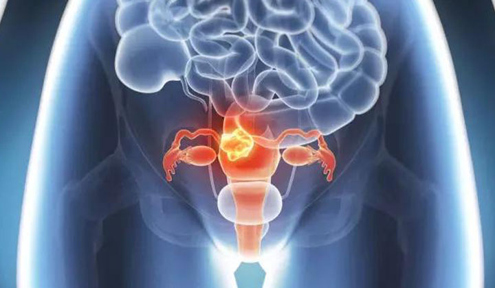 宫腔粘连常见的病症