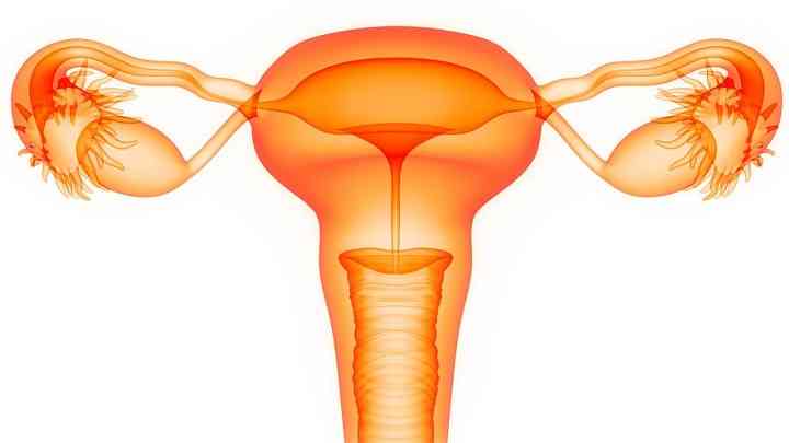 多囊卵巢能否治愈