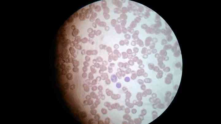 显微镜下的白细胞图图片