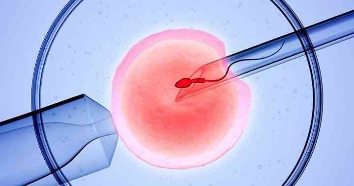 多囊卵巢能不能做试管婴儿