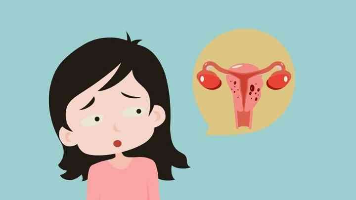 子宫肌瘤症状表现