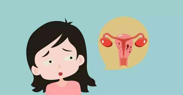 子宫肌瘤手术后可以怀孕吗