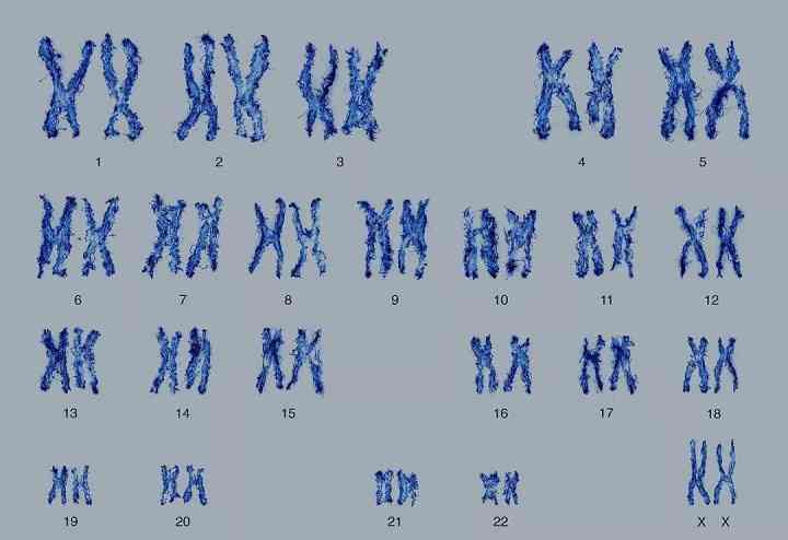 性染色体xo图片