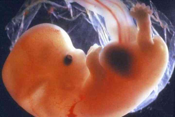 胎儿染色体异常的症状