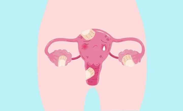 子宫内膜厚有哪些影响