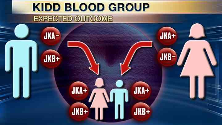kidd血型是稀有血型