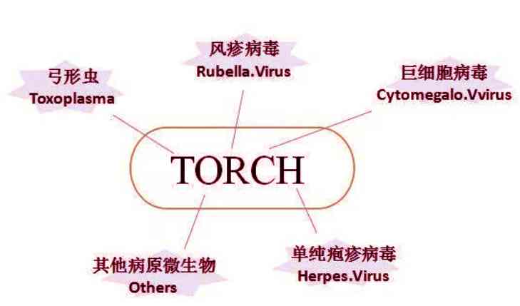 torch检查可以检查出五大病毒疾病