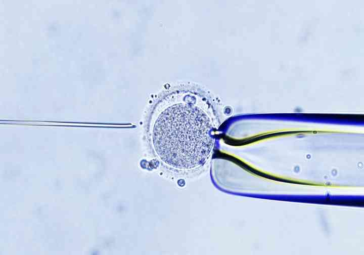 输卵管缺失移植过程