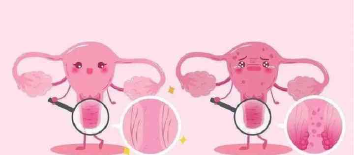 卵巢囊肿分为功能和非功能两类