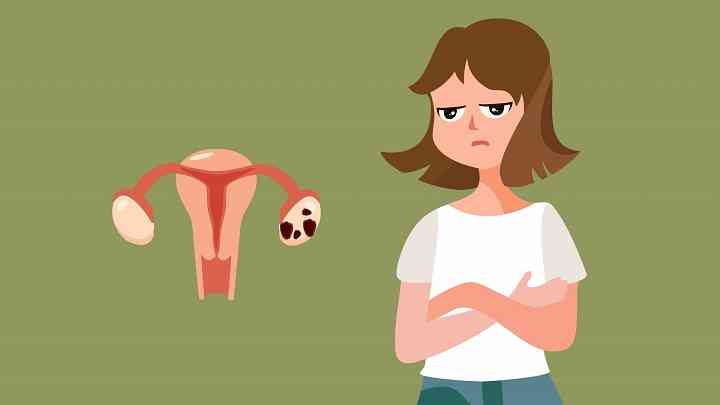 子宫肌瘤该如何预防