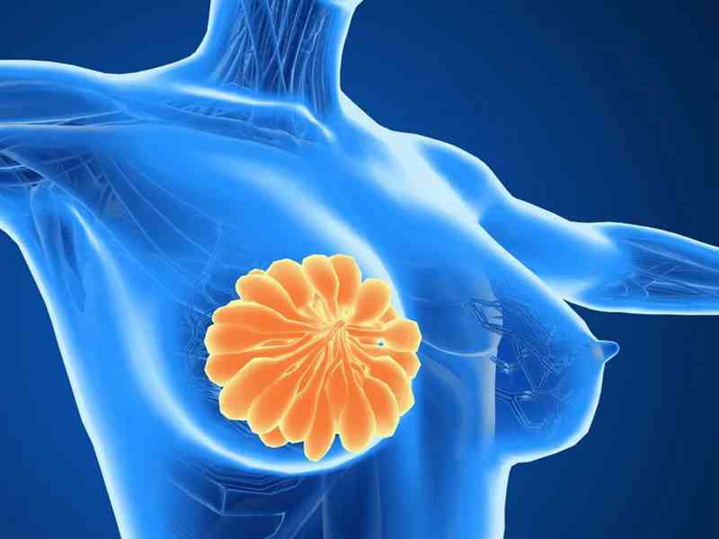 纤维囊性变会产生乳腺结节