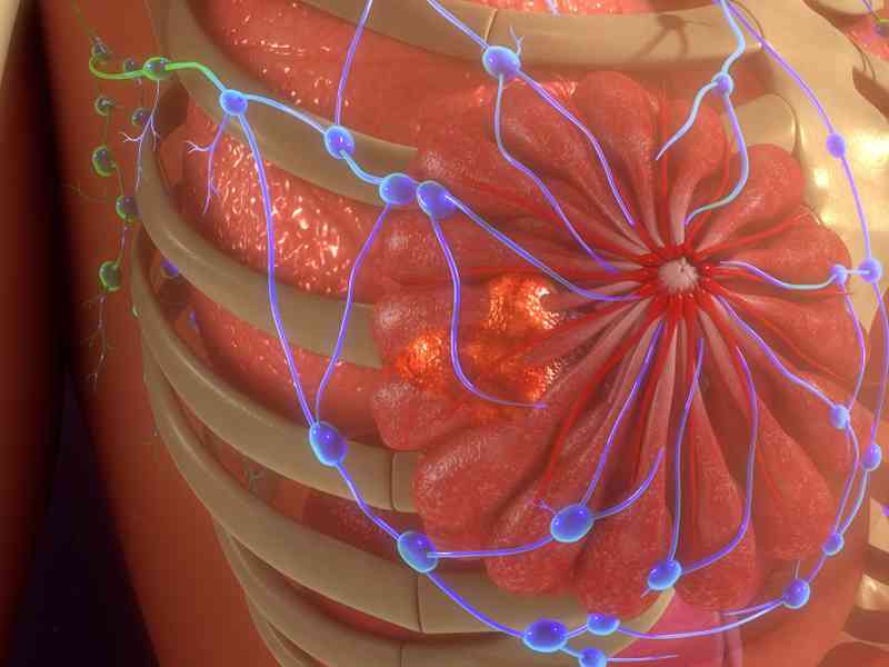 乳腺纤维瘤可能引发硬化性乳腺病
