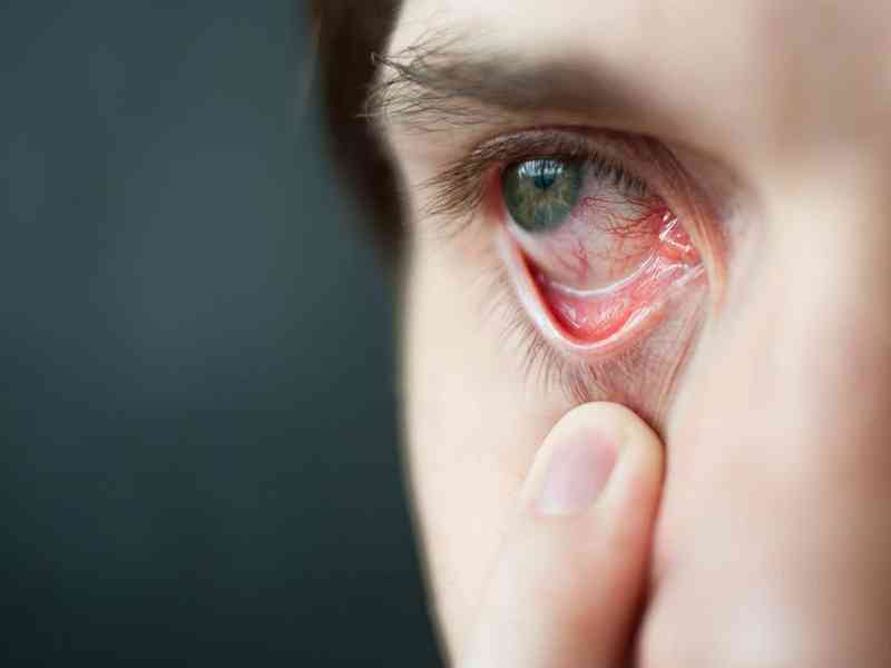 红霉素眼膏有促进创口愈合，又有防止敷料粘连创面的作用。