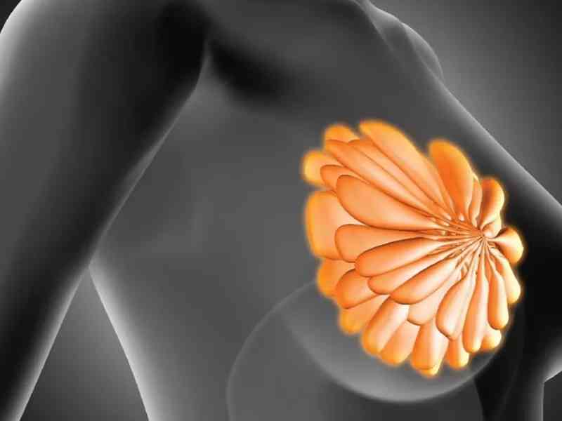 乳腺纤维瘤包含复杂型纤维腺瘤