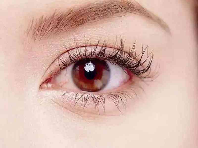 红霉素眼膏有保持眼部湿润、避免眼部粘膜干燥的作用