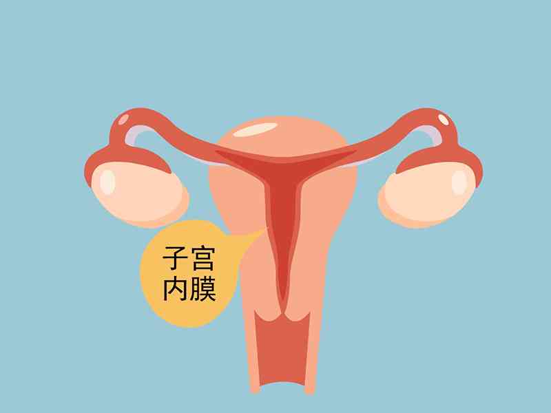 子宫内膜异常可能会导致胎盘前置