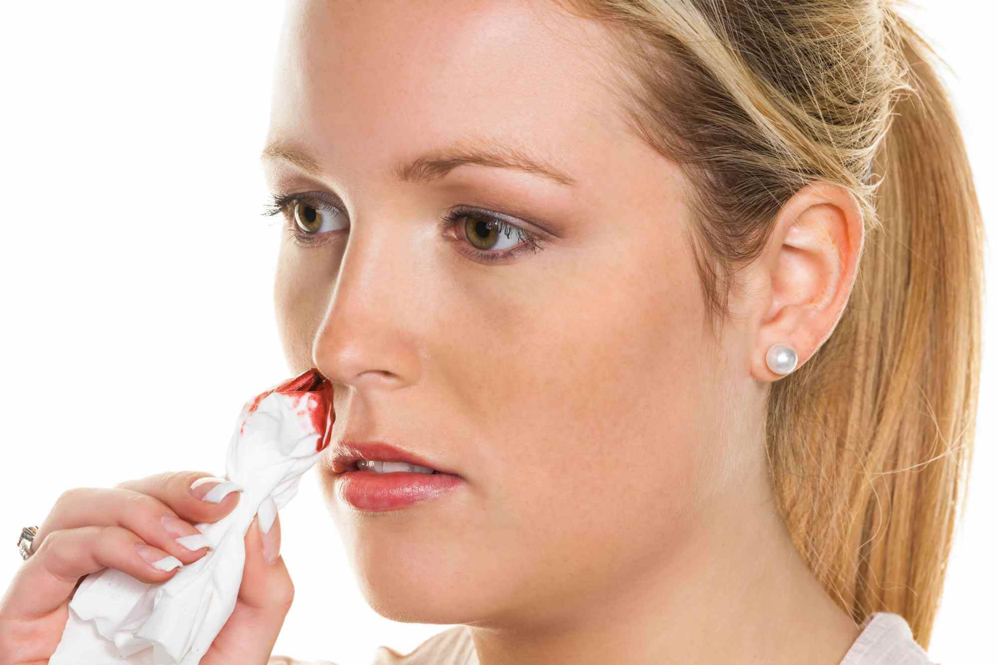孕期激素变化会导致流鼻血