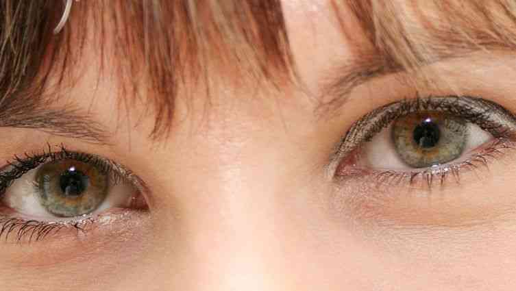 红眼病是有传染性的角膜炎症