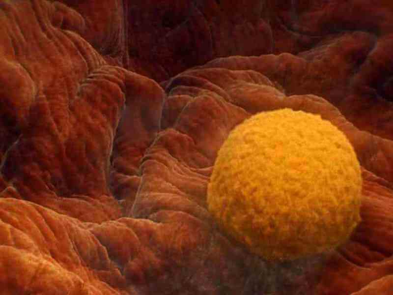 怀孕初期可能会出血