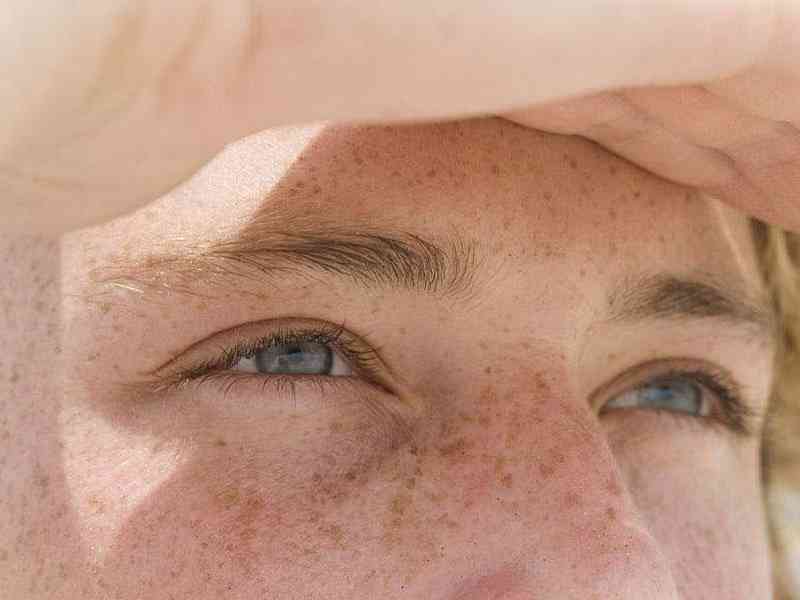 女性孕在孕期可能会有黄褐斑