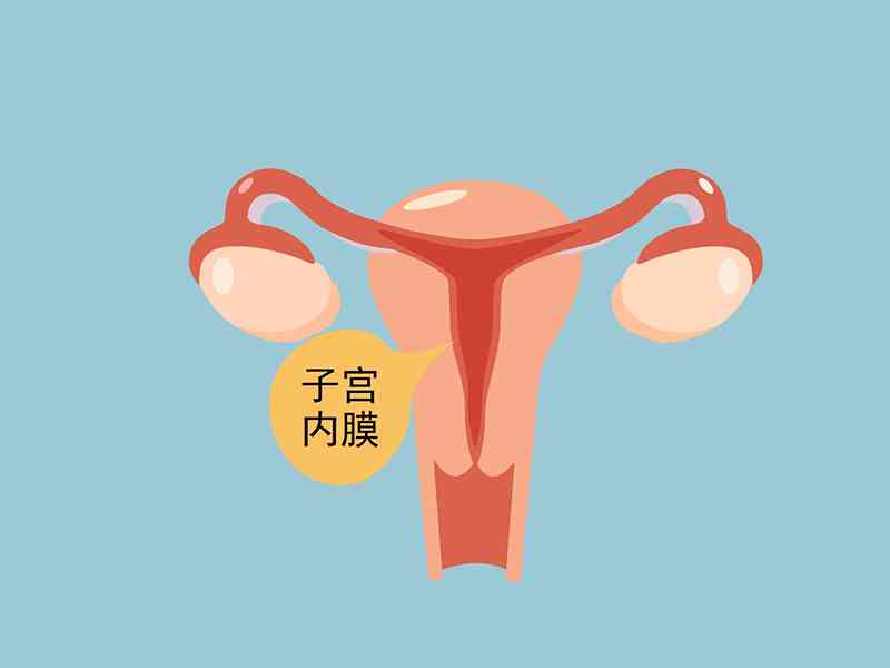 女性白带褐色可能是子宫内膜脱落导致的