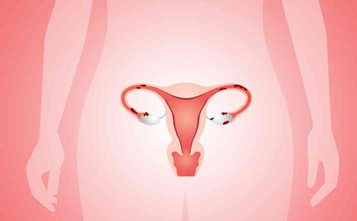 不孕女性要做宫腔镜检查