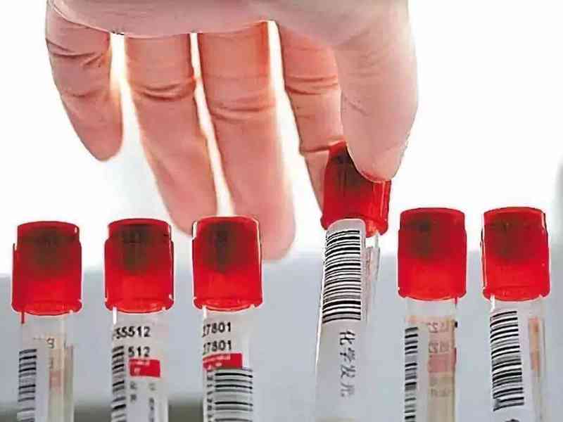 优生健康检查中需要进行血型检测