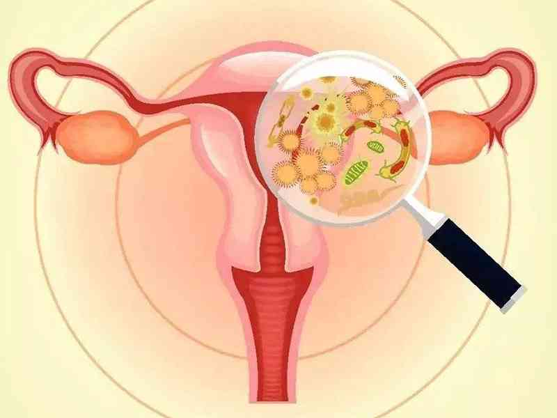 输卵管不孕可能是因为炎症