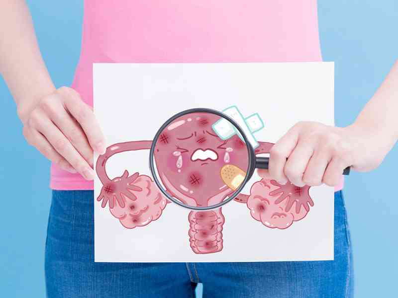 输卵管不孕可能是因为输卵管结核