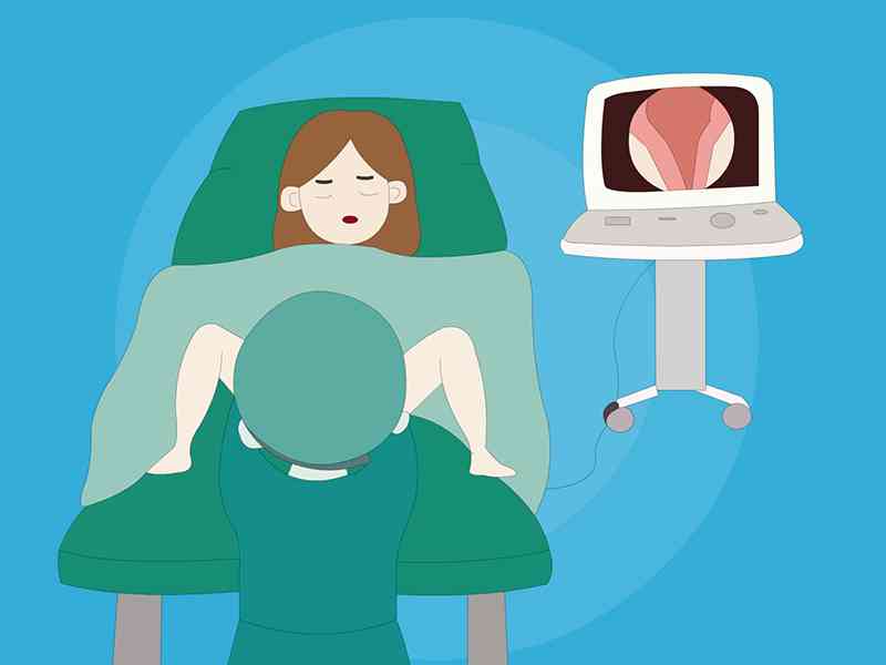 宫腔镜检查可以检测外阴性不孕