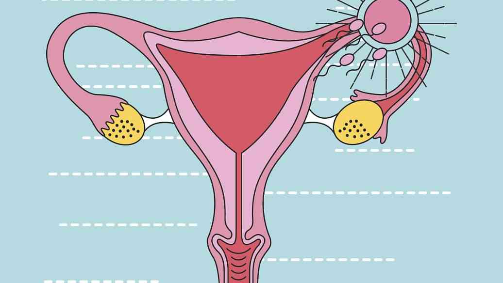子宫内膜异位性不孕有很多原因
