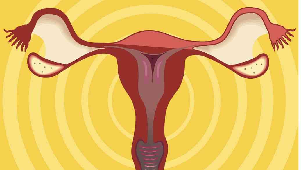 输卵管变型是子宫内膜异位性不孕的原因之一