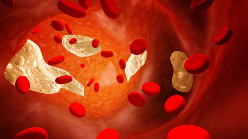 胆红素异常主要有三种原因