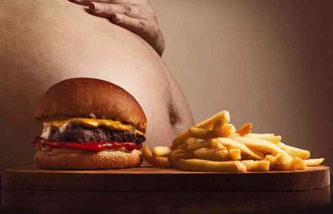 过度肥胖可能导致胆红素异常
