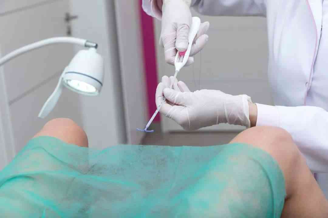 取环后半年怀孕最安全