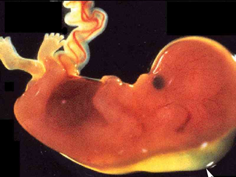 六周流产胚胎图片图片